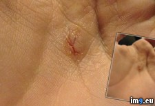 Tags: stabbed, wtf (Pict. in My r/WTF favs)