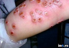 Tags: contracted, cowpox, cows, disease, disfiguring, fatal, human, virus, wtf (Pict. in My r/WTF favs)