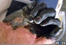 Tags: bubonic, hand, plague, victim, wtf (Pict. in My r/WTF favs)