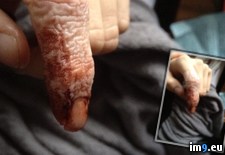 Tags: alcohol, bandage, finger, soaked, wrapped, wtf (Pict. in My r/WTF favs)
