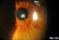 Tags: eye, growing, iris, lens, wtf (Pict. in My r/WTF favs)