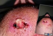 Tags: mrsa, tuesdays, wtf (Pict. in My r/WTF favs)
