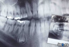 Tags: dentist, discovered, growing, gums, tooth, upside, wtf (Pict. in My r/WTF favs)