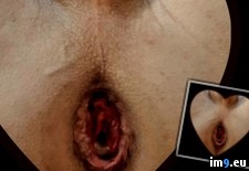 ztLT4ceH (#Gay #Fag #Faggot) - 52 KB Tags: fag, faggot, gay (Pict. in Fariss Von Rundstedt)