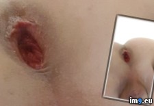 zyd3DDWI (#Gay #Fag #Faggot) - 68 KB Tags: fag, faggot, gay (Pict. in Fariss Von Rundstedt)